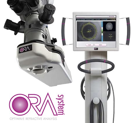 ORA Cataract Laser System