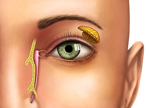 Medical Illustration of Tear Ducts